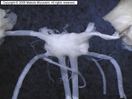 Invertebrate Brain Platform